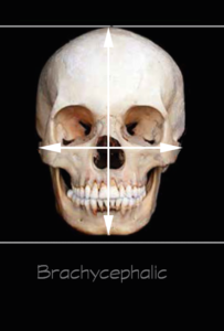 Brachyephalic
