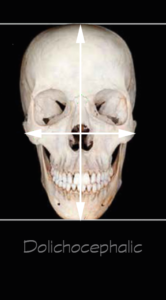 Dolichocephalic