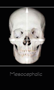 Mesoephalic